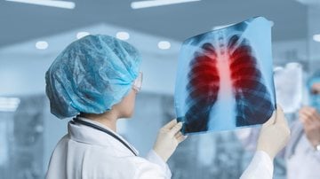 A pneumonia é responsável por mais de 600 mil internações por ano no país - Imagem: Natali_Mis/iStock