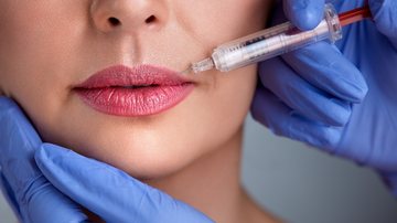 Confira 5 benefícios do preenchimento labial. - LuckyBusiness/ iStock