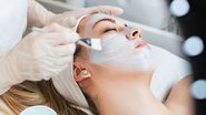 O avanço da estética aumentou as possibilidades de peeling para cada rosto. - DuxX/ iStock