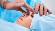 A rinoplastia reparadora é um procedimento cirúrgico que vai além da estética. - YakobchukOlena/istock