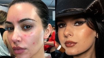 Confira as famosas que já falaram sobre acne. - Reprodução/Kim Kardahian/Ana Castela