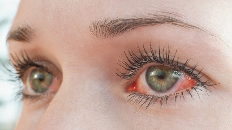 Cuide bem dos seus olhos contra os malefícios do tempo seco. - Tunatura/ iStock