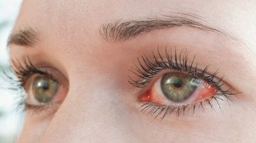 Cuide bem dos seus olhos contra os malefícios do tempo seco. - Tunatura/ iStock