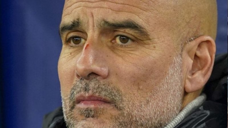 O técnico do Manchester City apresentou arranhões preocupantes na face. - (Reprodução / Divulgação)