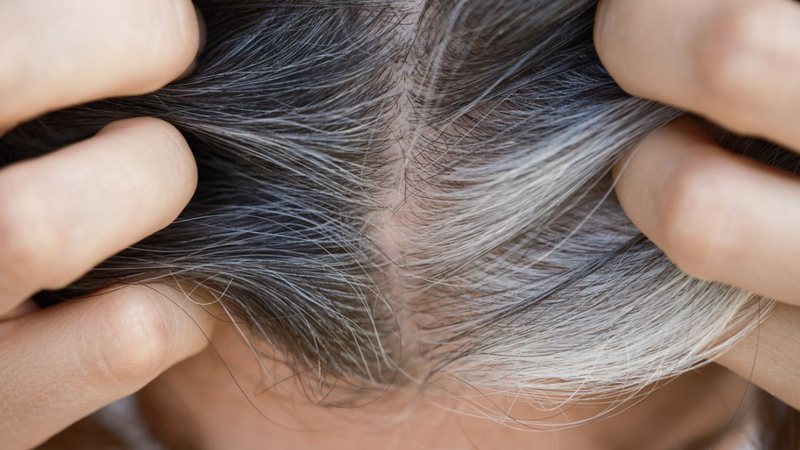 Mesmo assim, é importante avaliar se a mudança é normal ou está relacionada a outra questão. - Professor25/iStock