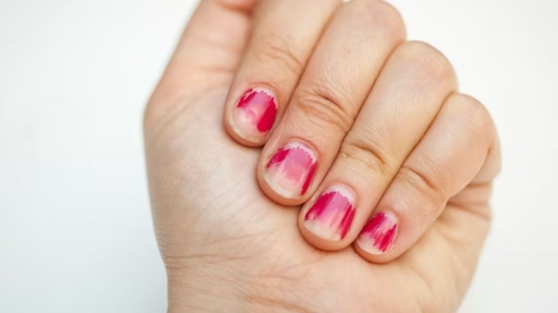 O esmalte descascado compromete a aparência das unhas. - Reprodução / Pinterest