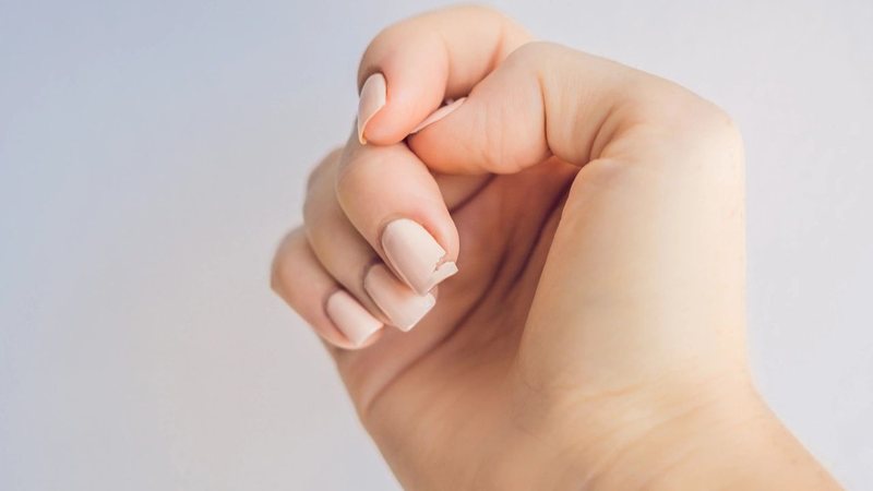 As unhas quebradas podem representar um problema estético para o dia a dia. - Reprodução / Freepik