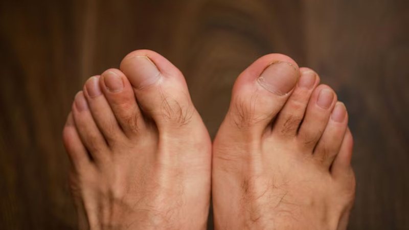 As ondulações nas unhas podem ser um alerta para a saúde. - Reprodução / Freepik