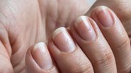 O aspecto das unhas pode indicar muito sobre a sua saúde. - Reprodução / Freepik