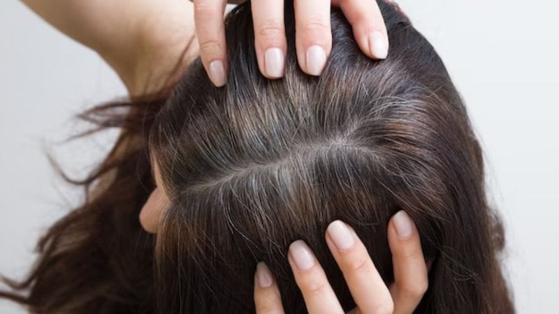 É possívle retardar o surgimento dos fios grisalhos através de uma boa nutrição. - Reprodução / Freepik