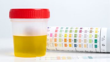 A cor da urina pode indicar muito sobre o estado do seu corpo. - Reprodução / Freepik