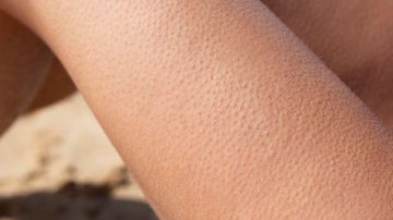 Os arrepios são resposta física para uma série de emoções. - Reprodução / Freepik