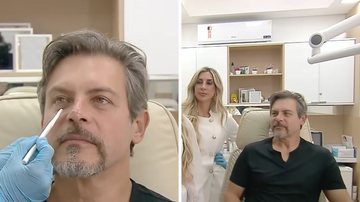 O ator Luigi Baricelli passou pelo procedimento de harmonização facial.