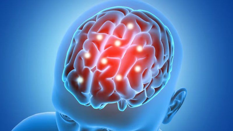 imagem gráfica de cérebro envolto por meninge inflamada