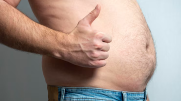 Homem com barriga protuberante exibindo acúmulo de gordura abdominal.