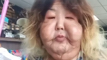 Juju do Pix sob fundo neutro, com rosto inchado, posando para a câmera.