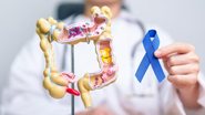 médico ao lado de imagem de intestino.