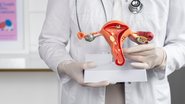 médico segurando um modelo de útero