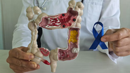 Médico com demonstração de intestino afetado por câncer.