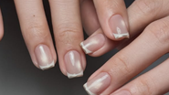 unhas