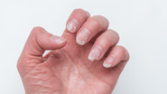 unhas