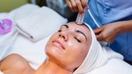 melhor época para fazer peeling