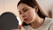 adolescente olhando seu rosto cheio de acne no espelho.