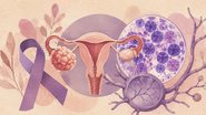 tumor raro nos ovários e linfoma