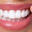 sorriso com dentes brancos.