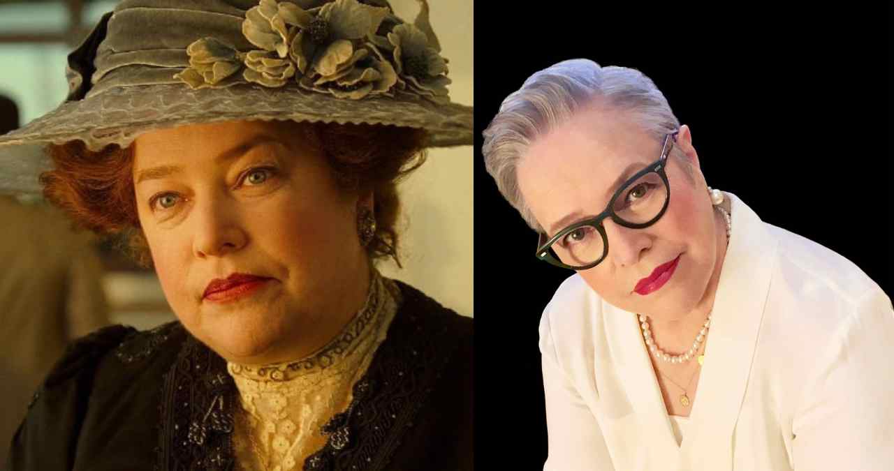 Antes e depois de Kathy Bates