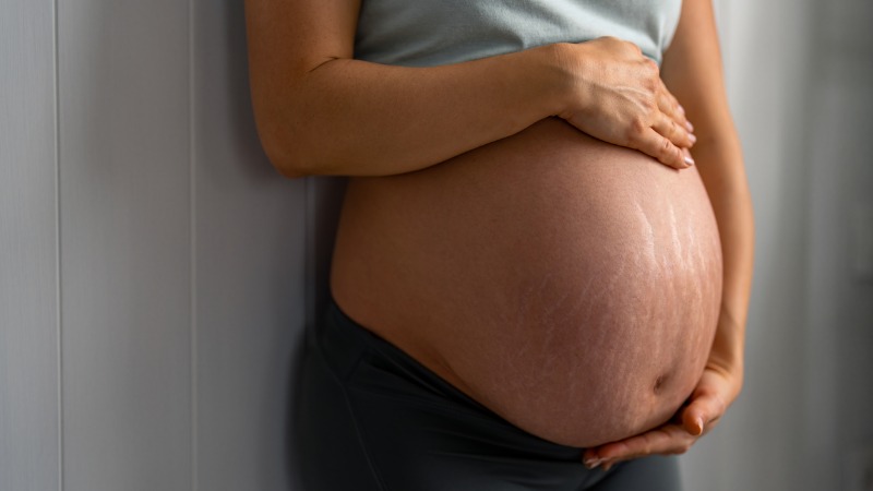 Mulher grávida segurando sua barriga e mostrando suas estrias.