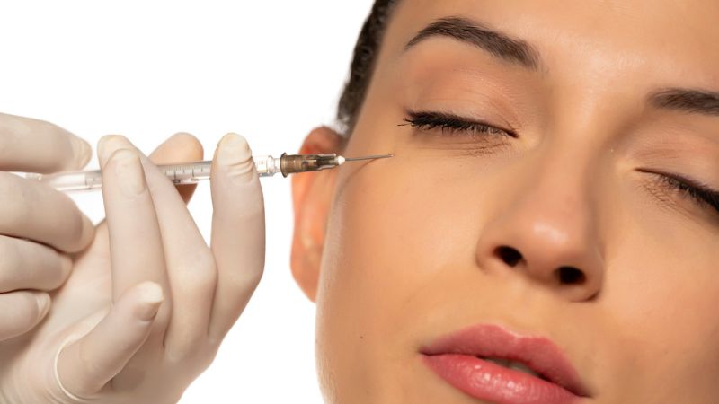 onde aplicar o botox preventivo