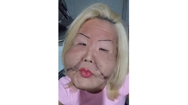 Juju do Pix com cabelos loiros e vestindo rosa, mostrando resultados de cirurgia.