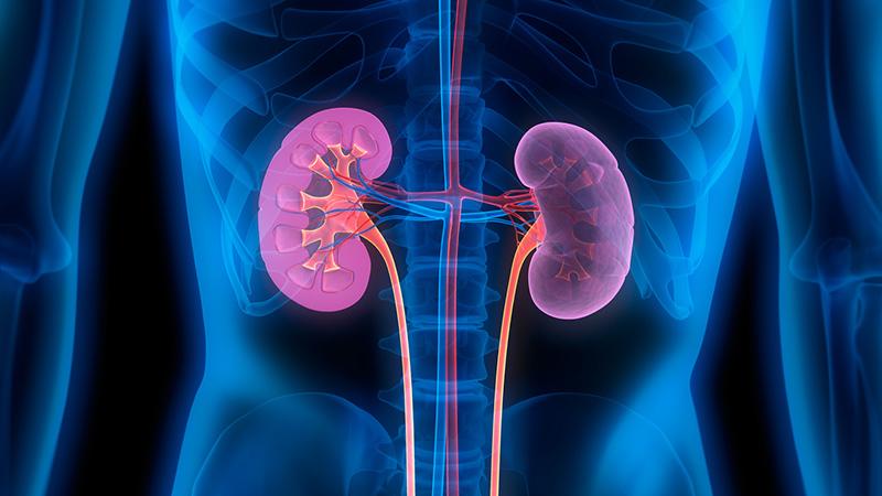 A Síndrome de Haff pode causar insuficiencia renal