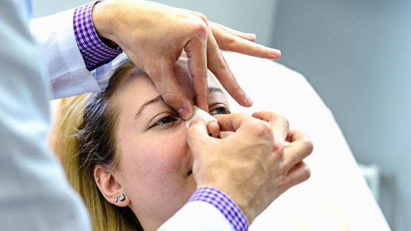 cuidados pos operatorios rinoplastia